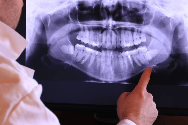 Best Emergency Dentist for Knocked-Out Tooth in Dublin, VA