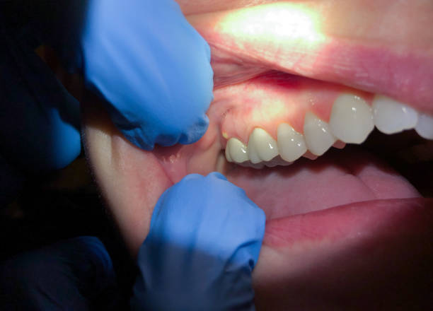 Best Mobile Emergency Dentist in Dublin, VA